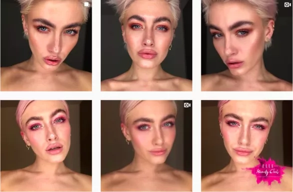 Brow lifting Brow lifting