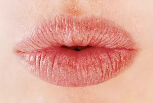 KDO CHCE (VĚTŠÍ) PUSU? KDO CHCE (VĚTŠÍ) PUSU?