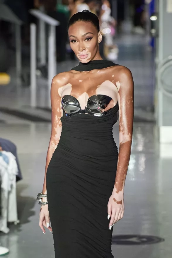 Winnie Harlow Winnie Harlow