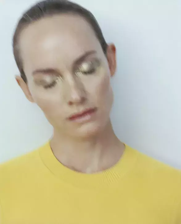 Baby botox Baby botox