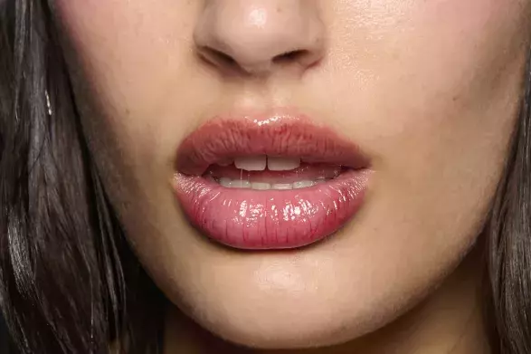 Migrace výplní Migrace výplní