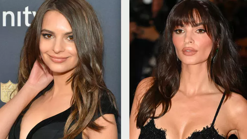 Plastiky celebrit Plastiky celebrit